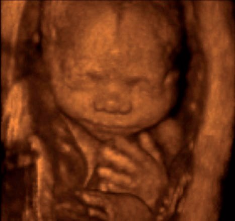 échographie photo du fœtus dans le cadre, femme enceinte au lit