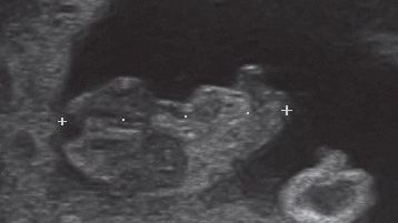 La Grande Histoire De Ma Grossesse En Echographies La Grande Histoire De Ma Grossesse En Echographies