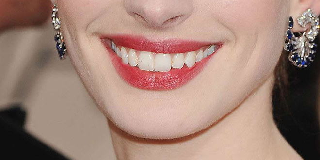 Das Lächeln der Stars Erkennen Sie den Promi?