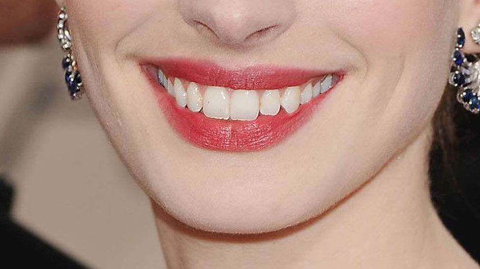 Las sonrisas de las celebrities: ¡Adivina a quién pertenecen!