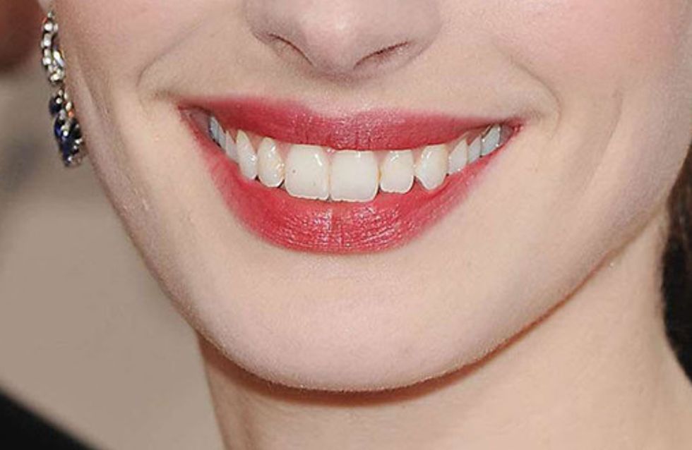 Las sonrisas de las celebrities: ¡Adivina a quién pertenecen!