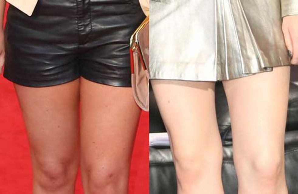 Celebrity legs: Pins we'd love to have