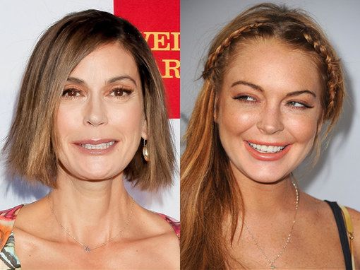 Botox avant et après célébrité