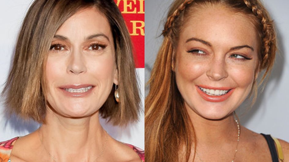 Celebridades e Botox