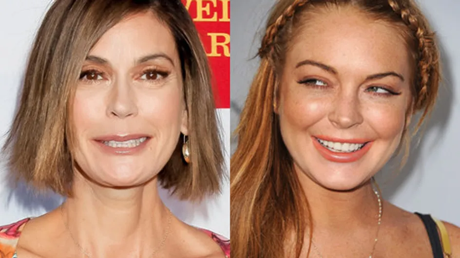 Celebrities Who Use Botox: Frozen In Time