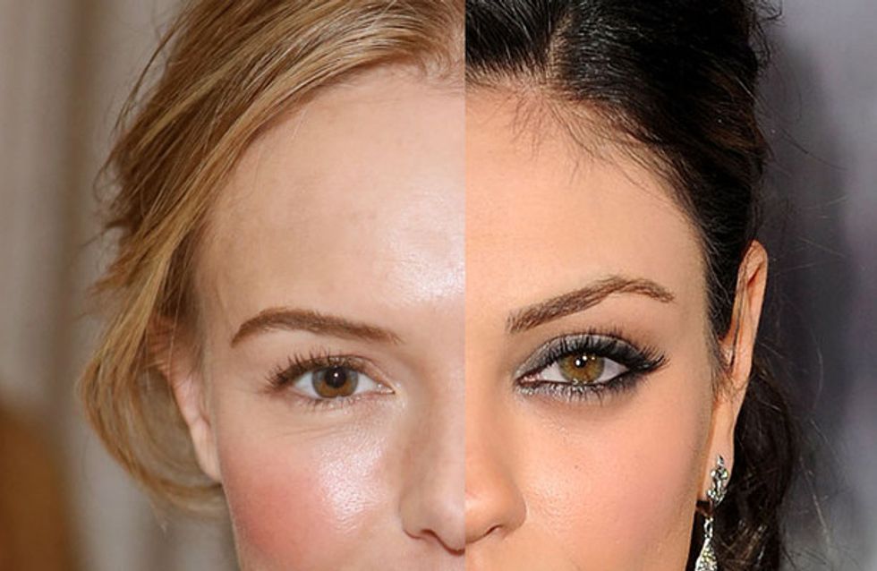 Famosos com heterocromia