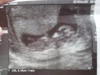 segundo bebe 
