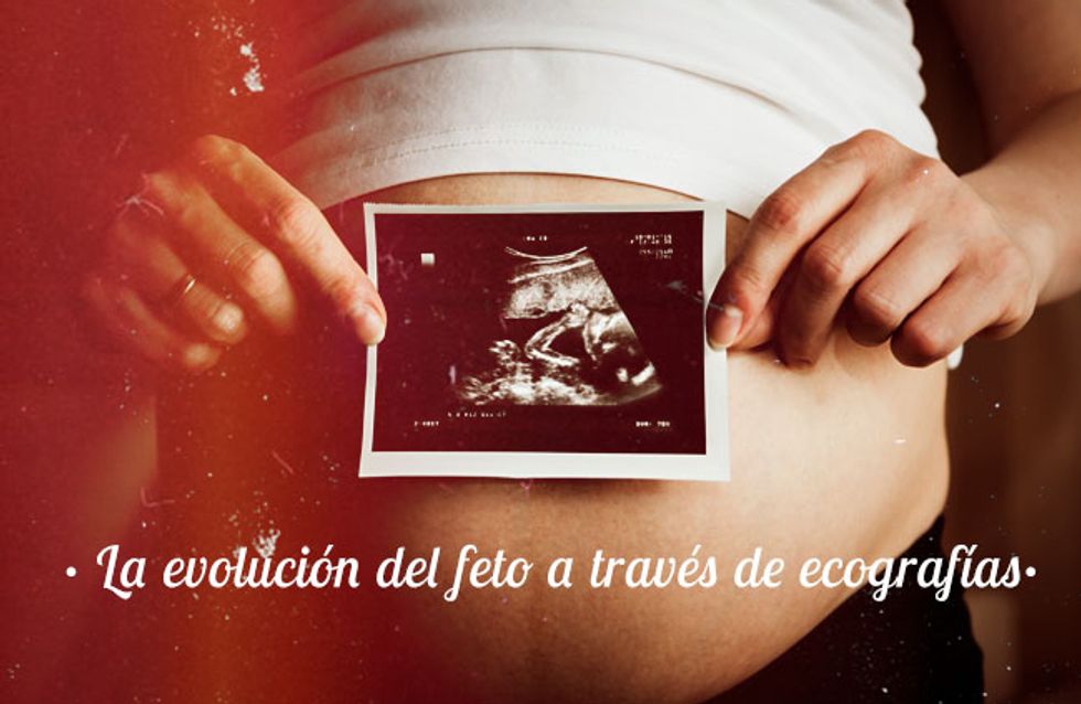La evolución del feto a través de ecografías