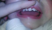 Zahn abgebrochen stück Mini Stück