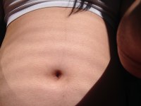 Chiarimento Cosa Si Intende Per Depilazione Totale