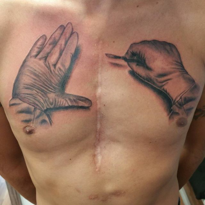 Tatuajes para cubrir cicatrices