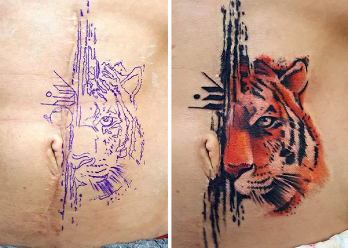Tatuajes para cubrir cicatrices