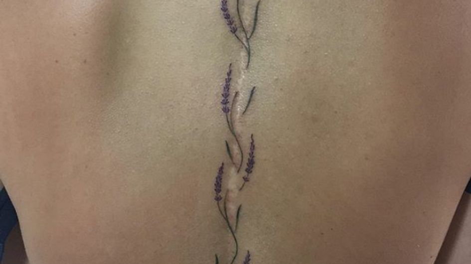 35 tatuajes para cubrir una cicatriz. ¡Conviértelas en parte del diseño!
