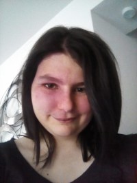 Bebe Avec Angiome Au Visage Regard Des Autres Difficile