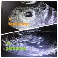 Como Se Ve Un Bebe De 6 Semanas En Una Ecografia Consejos De Bebe