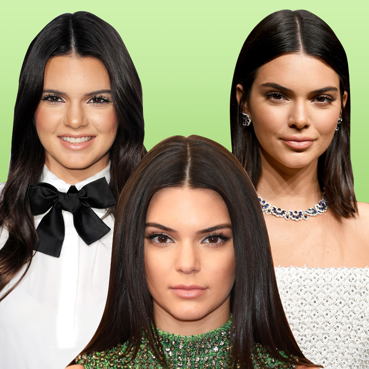 La evolución facial de Kendall Jenner