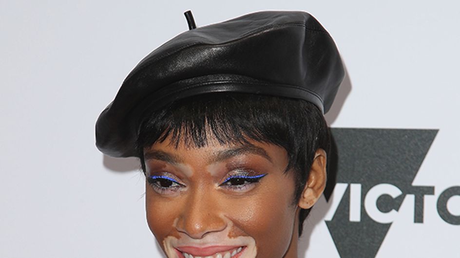 Winnie Harlow: Model, Activist & All Round Babe