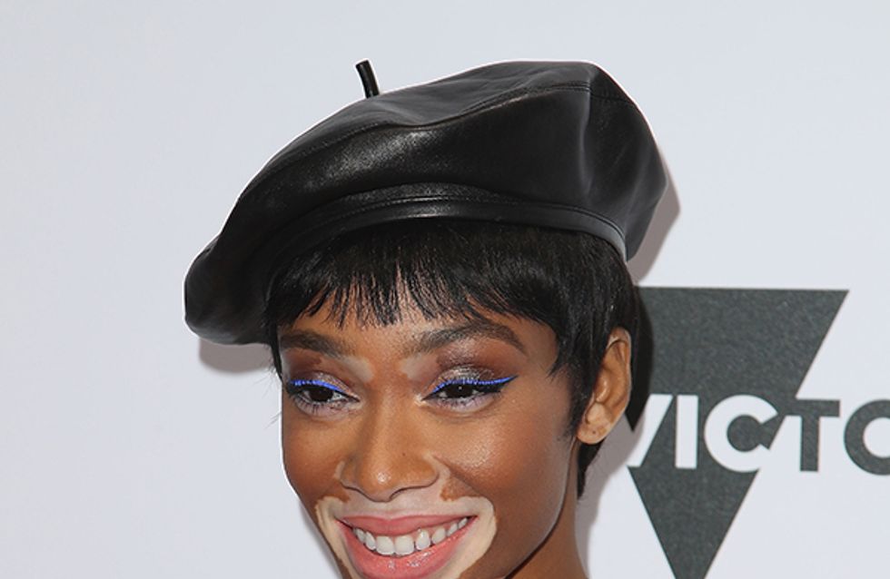 Winnie Harlow: Model, Activist & All Round Babe