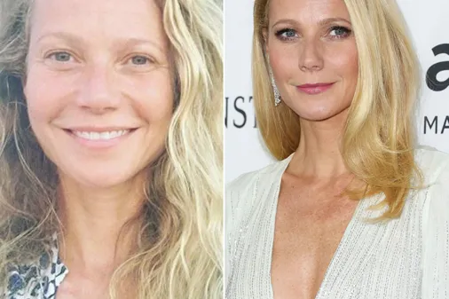 Stars ungeschminkt vs. geschminkt
