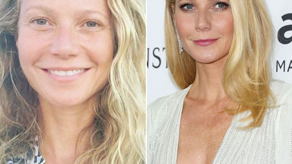 Stars ungeschminkt: Die nackte Wahrheit ganz ohne Make-up