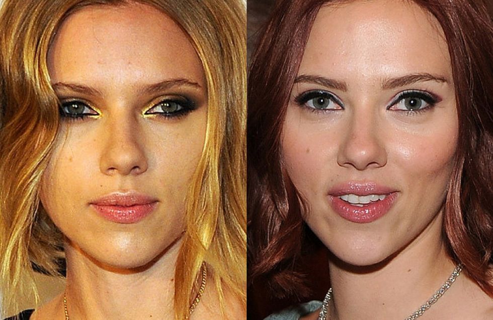 famosas antes y despues de adelgazar fotos de amor