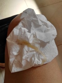 Que es el tapon mucoso cuando estas embarazada