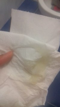 Como perder liquido amniotico