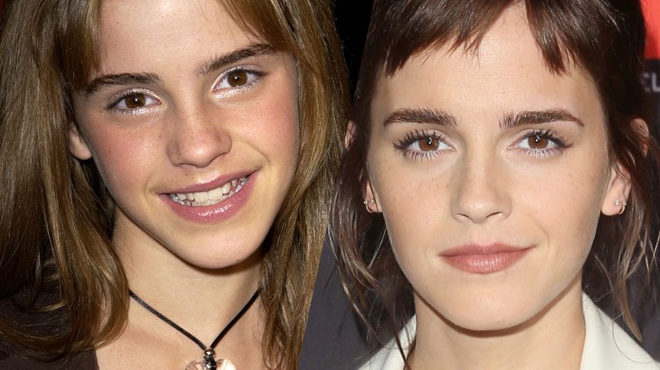 The evolution of Emma Watson's beauty