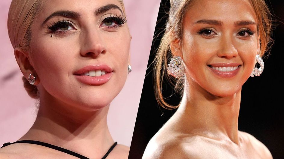 Estas famosas demuestran que tener estrías es lo más normal del mundo
