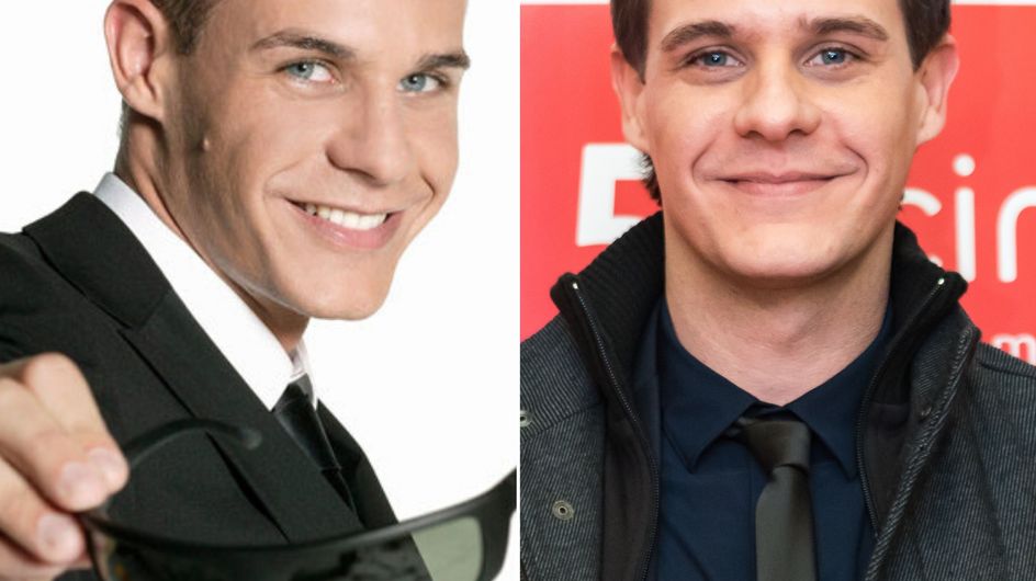 ¡Dramón capilar! Famosos que se han animado con el injerto de pelo