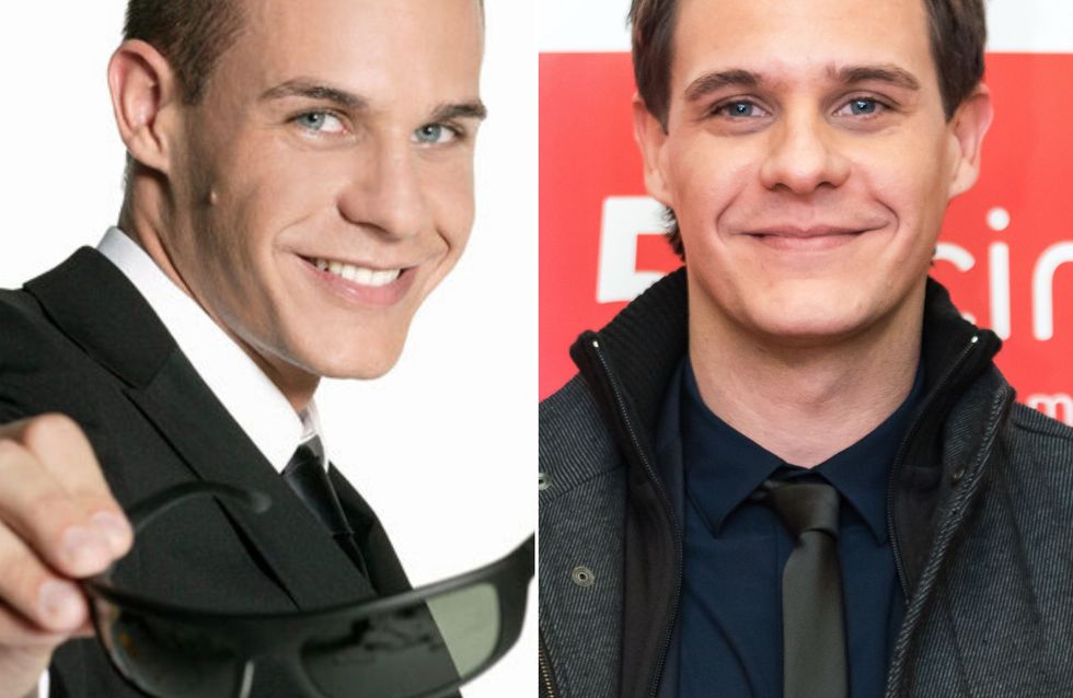 ¡Dramón capilar! Famosos que se han animado con el injerto de pelo