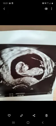 Clarte Nucale Avis Clarte Nucale Avis