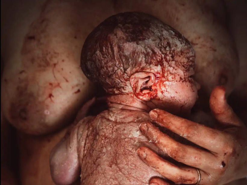 Accouchement : les plus belles et poignantes photos de naissance 2022 