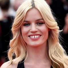 Famosos con diastema
