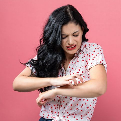 Cómo aliviar el picor de la urticaria