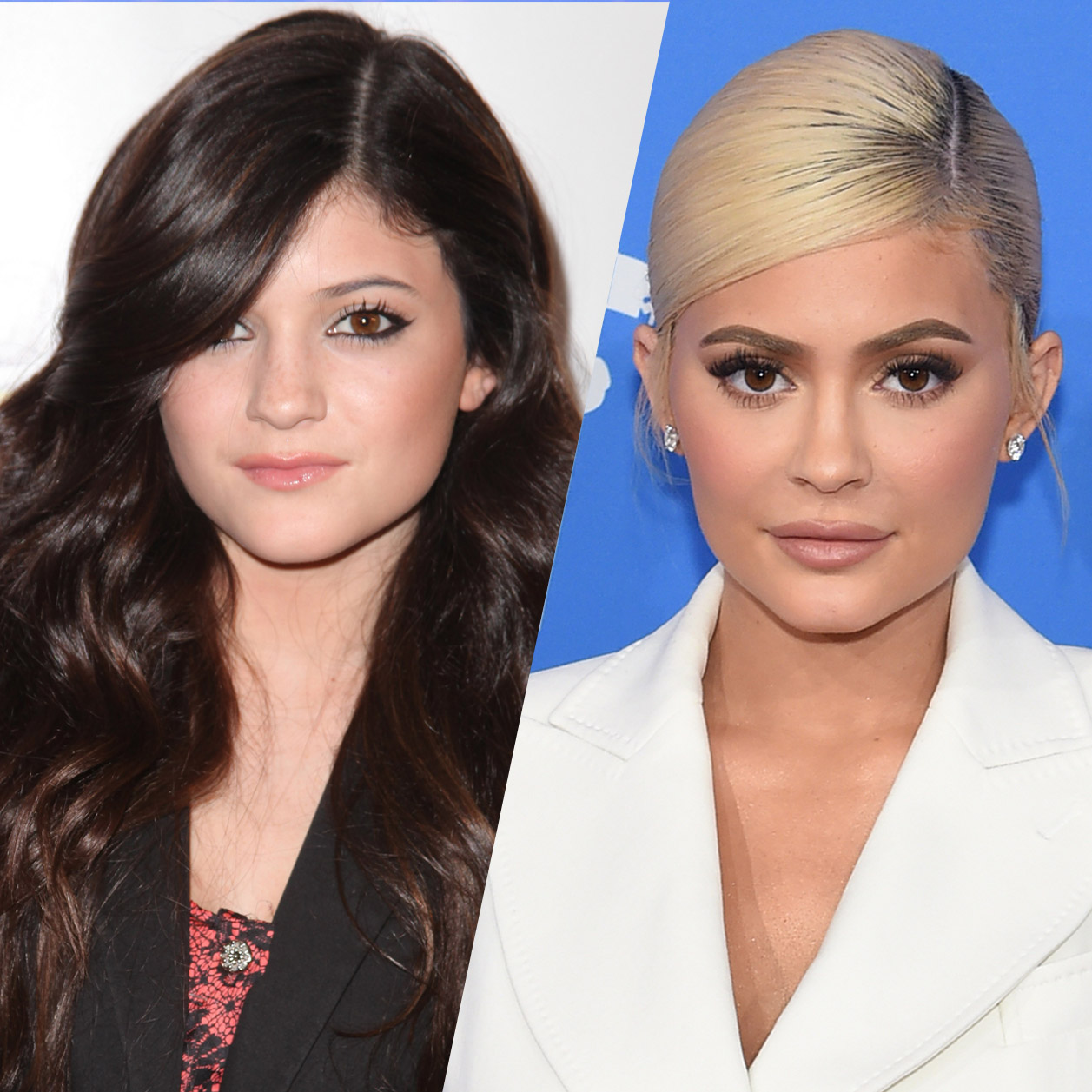 Retour Sur Lincroyable évolution Beauté De Kylie Jenner 