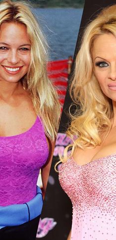 Zoom sur l'évolution beauté de Pamela Anderson
