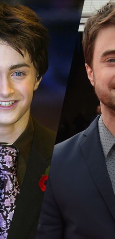 Daniel Radcliffe célèbre ses 30 ans ! Retour sur l'évolution physique du légendaire Harry Potter