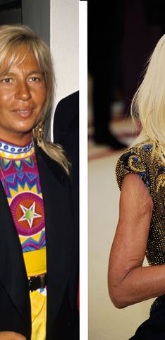 La evolución de Donatella Versace: un cambio drástico con cirugía