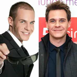 ¡Dramón capilar! Famosos que se han animado con el injerto de pelo