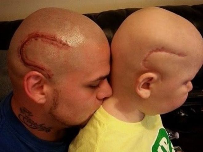 Usa Un Papa Se Tatoue La Cicatrice De Son Fils