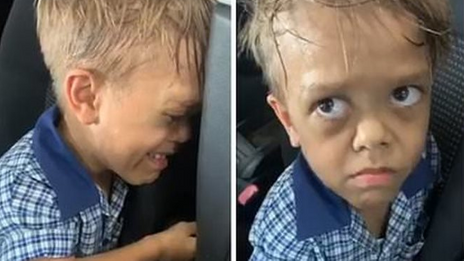 Je Veux Mourir La Video Dechirante D Un Enfant Atteint De Nanisme Victime De Harcelement
