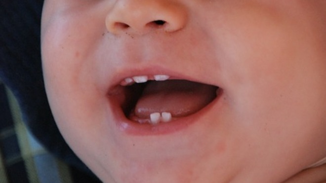 Embrasser Son Bebe Sur La Bouche Un Danger Pour Les Dents De Lait