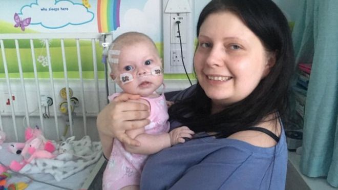 Angleterre Cette Petite Fille Pourrait Mourir D Un Simple Bisou De Sa Maman