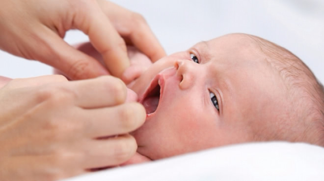Reflux Gastrique Les Raisons Et Solutions Des Regurgitations