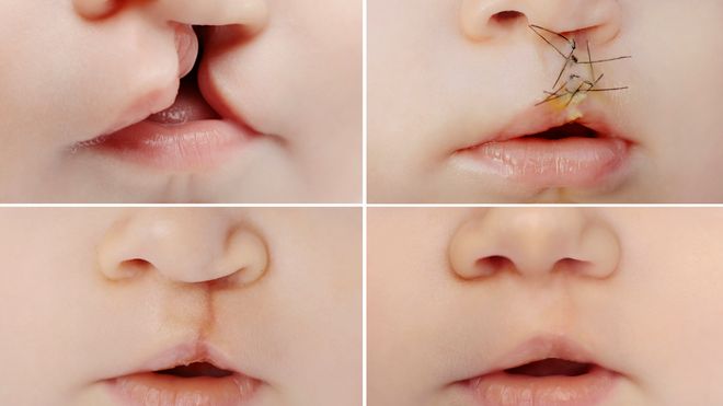 Comment Savoir De Quelle Couleur Les Yeux De Bebe Seront