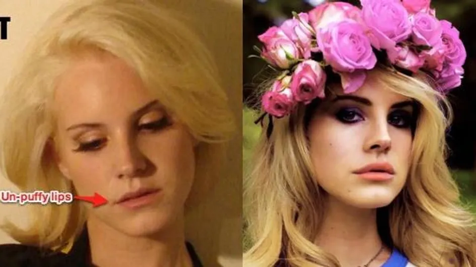 Lana Del Rey : Ses lèvres seraient 100% "naturelles"
