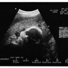 Fœtus party : Quand la grossesse devient un show
