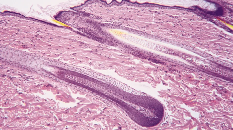 Infertilité : Des ovocytes créés à partir de cellules-souches