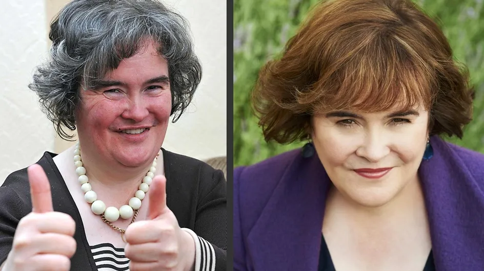 Susan Boyle : Son incroyable transformation ! (avant/après)